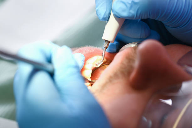 Best Cracked Tooth Emergency Dentist  in Wheatland, WY